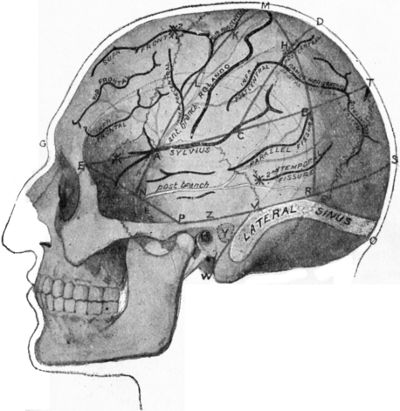 Fig. 186.—Relations of the Middle Meningeal Artery and
Lateral Sinus to the surface as indicated by Chiene's Lines.