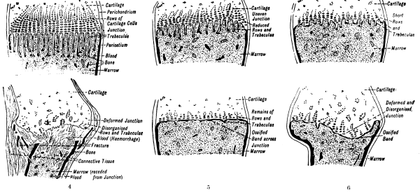 Diagrammatic representation of guinea-pig scurvy