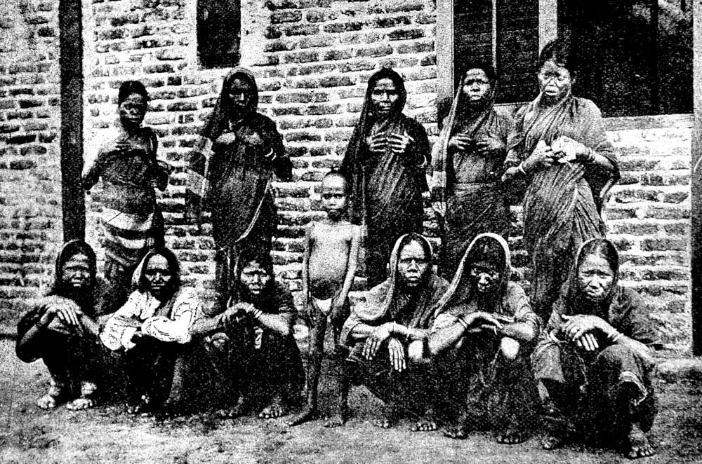 Female Lepers