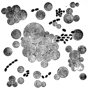 Fig. 5. Microscopic appearance of milk showing relative
size of fat globules and bacteria.