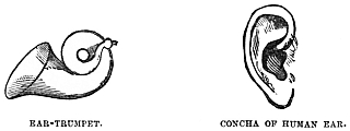 Image unavailable: EAR-TRUMPET.
CONCHA OF HUMAN EAR.
