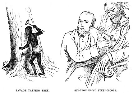 Image unavailable: SAVAGE TAPPING TREE.
SURGEON USING STETHOSCOPE.