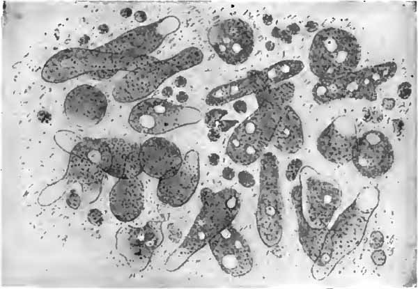 Amoeba coli in intestinal mucus