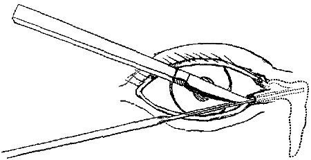 Fig. ix. Fig. ix.