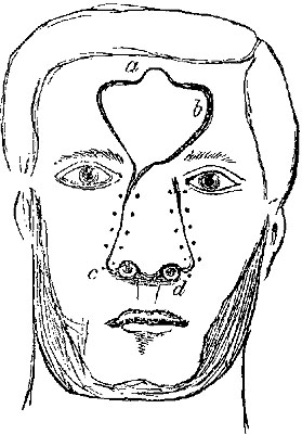 Fig. xviii. Fig. xviii.