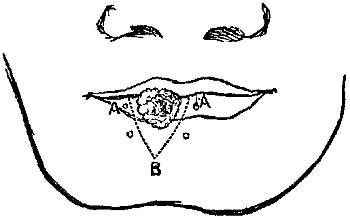 Fig. xix. Fig. xix.