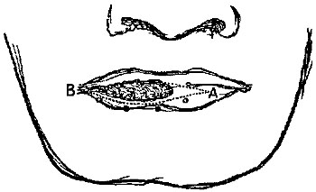 Fig. xx. Fig. xx.
