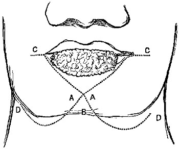 Fig. xxi. Fig. xxi.