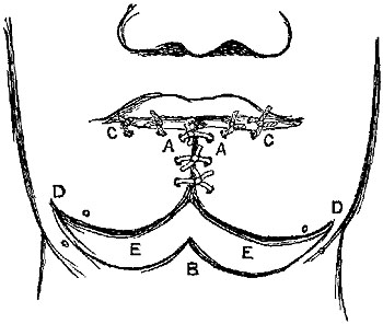 Fig. xxii. Fig. xxii.