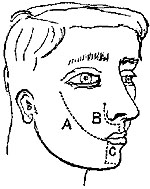 Fig. xxvii. Fig. xxvii.