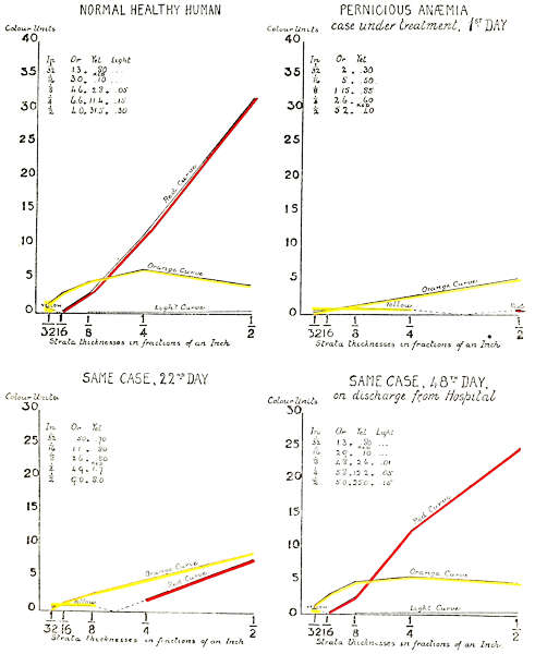 Normal Healthy Human.
Pernicious Anaemia. Same Case 22nd day. Same Case 48th day