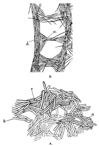 Illustration: Radial sections of fragments of the skeletons of
SpongillÃ¦