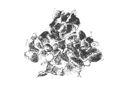Illustration: Fig. 31.—Part of the
zoarium of Victorella bengalensis entirely transformed into resting
buds, Ã 25. (From an aquarium in Calcutta.)
