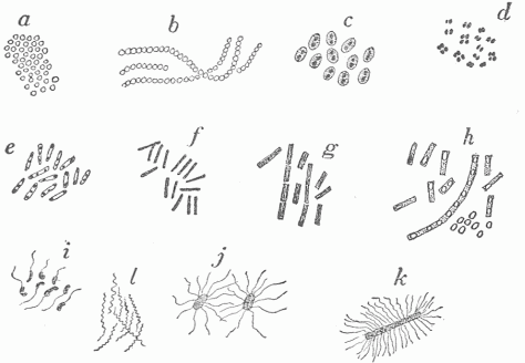 Fig. 17.—Various Forms Of Bacteria. a, b, c, d, Round bacteria or cocci: (a) Staphylococci, organisms which occur in groups and a common cause of boils; (b) streptococci, organisms which occur in chains and produce erysipelas and more severe forms of inflammation; (c) diplococci, or paired organisms with a capsule, which cause acute pneumonia; (d) gonococci, with the opposed surfaces flattened, which cause gonorrhoea. e, f, g, h, Rod-shaped bacteria or bacilli: (e) diphtheria bacilli; (f) tubercle bacilli; (g) anthrax bacilli; (h) the same bacilli in cultures and producing spores; a small group of spores is shown. (i) Cholera spirillÃ¦. (j) Typhoid bacilli. (k) Tetanus bacillus; i, j, k are actively motile, motion being effected by the small attached threads. (l) The screw-shaped spirochite which is the cause of syphilis.